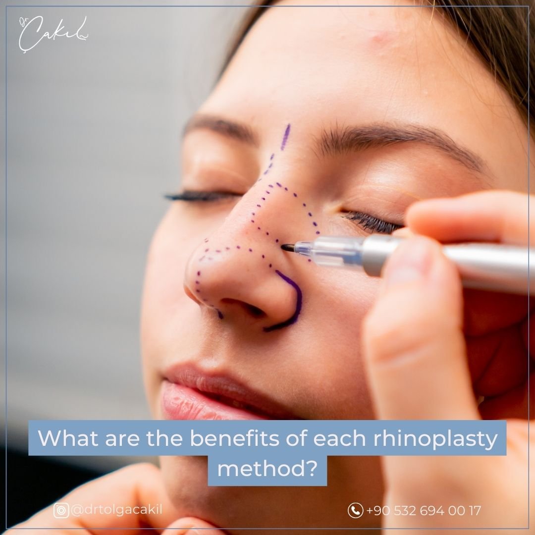 Different Rhinoplasty Methods