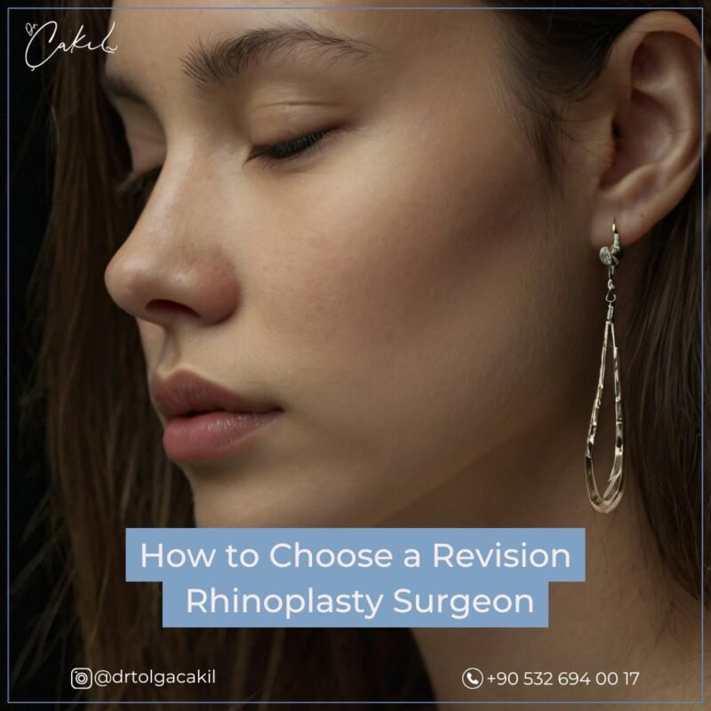 Choose Revision Rhinoplasty Surgeon