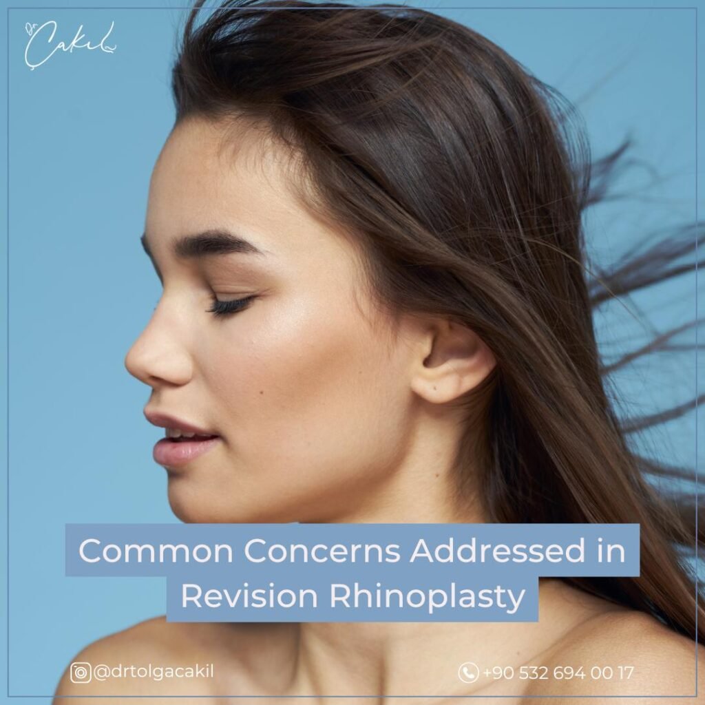 Revision Rhinoplasty Concerns