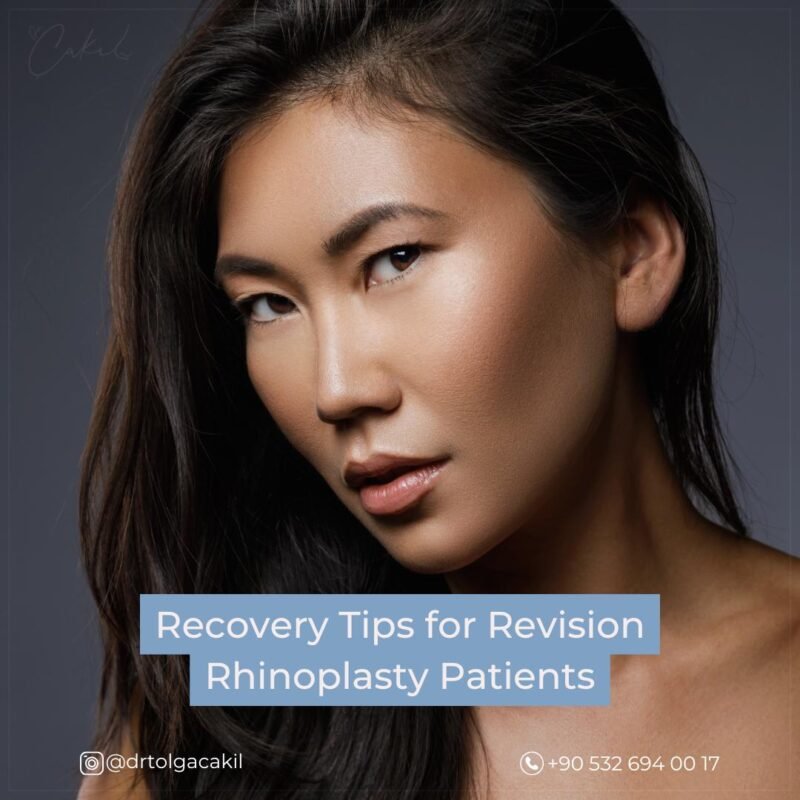 Revision Rhinoplasty Turkey Recovery