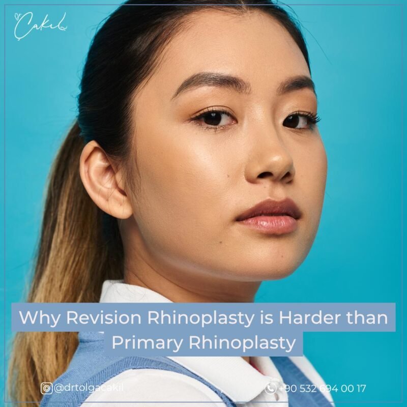 Primary vs Revision Rhinoplasty