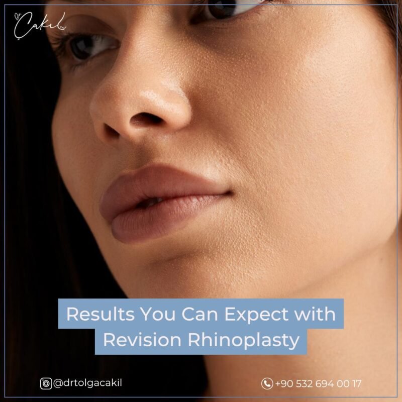 Choose Revision Rhinoplasty Surgeon