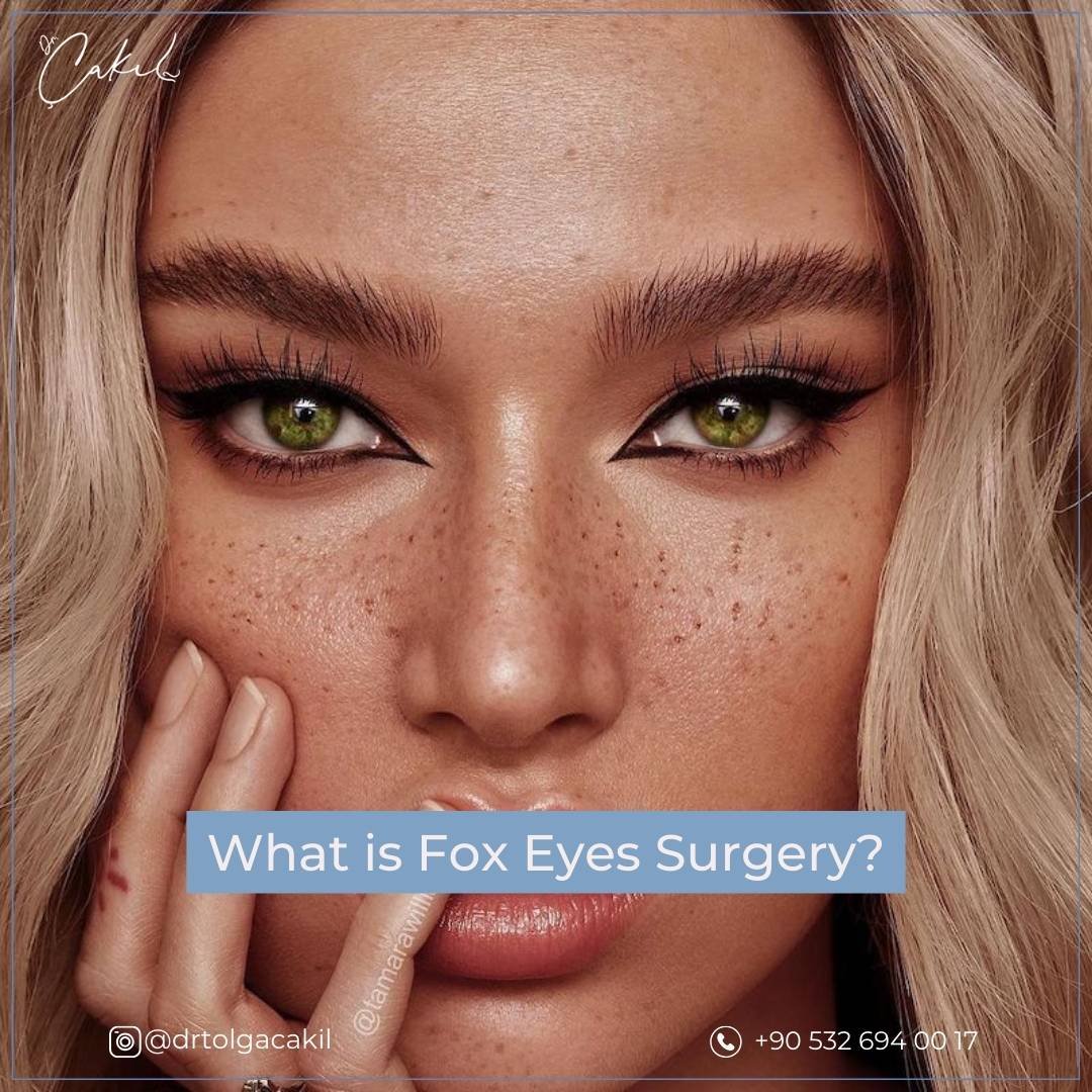 Fox Eyes Surgery Turkey