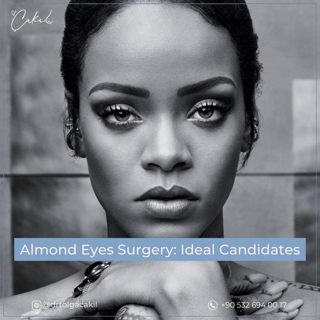 Almond Eyes Candidates Turkey