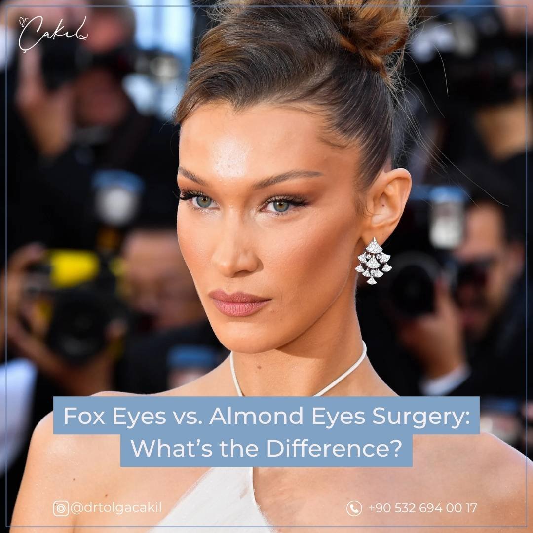 Almond Eyes Surgery Turkey