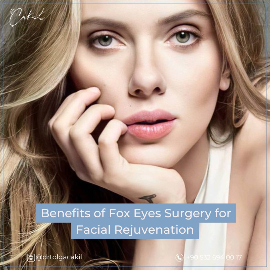 Benefits Fox Eyes Turkey