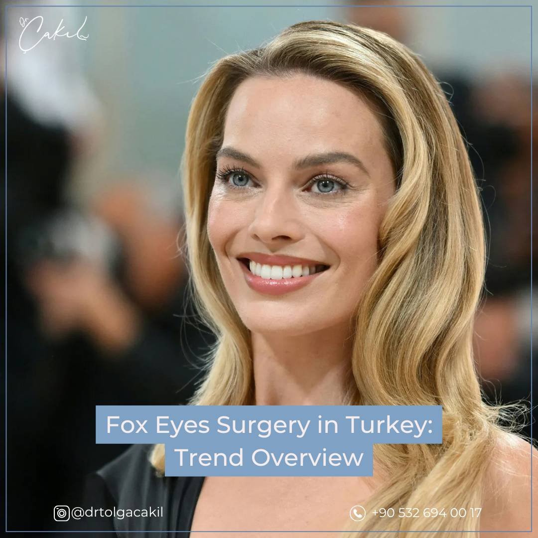 Fox Eyes Turkey Trend