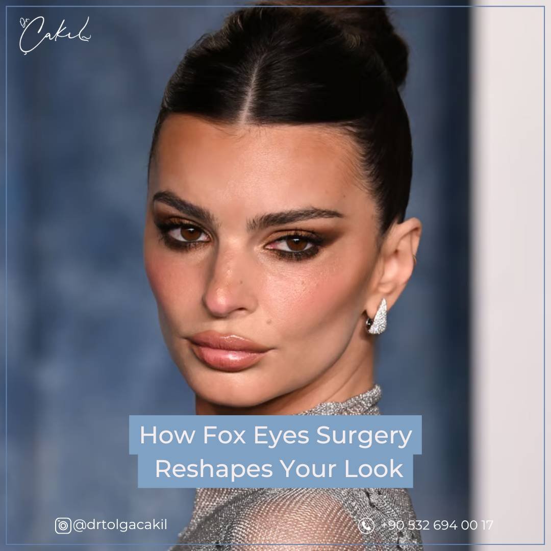 Endoscopic Fox Eyes Istanbul