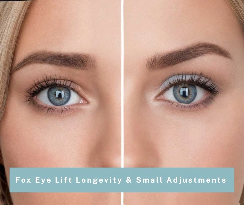 Fox Eye Lift Longevity & Small Adjustments